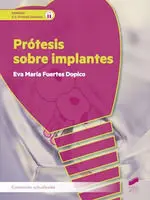 PROTESIS SOBRE IMPLANTES CFGS