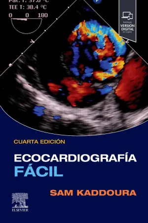 ECOCARDIOGRAFIA FACIL +STUDENT CONSULT