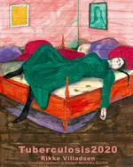 Tuberculosis 2020